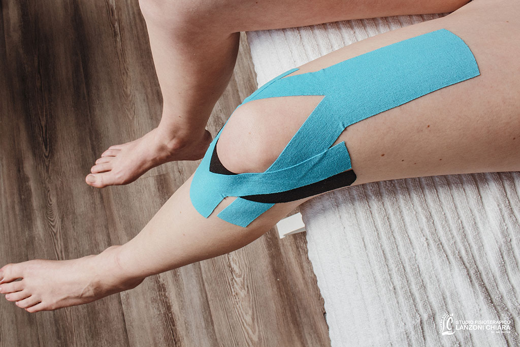 Taping Kinesiologico Neuromuscolare | FISIOTERAPIA LC